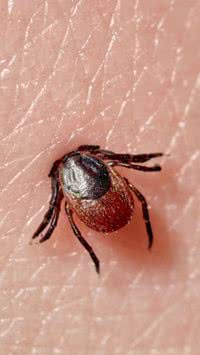Febre maculosa