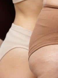 Musculação ou dieta? Saiba qual método é mais eficiente no combate a celulite
