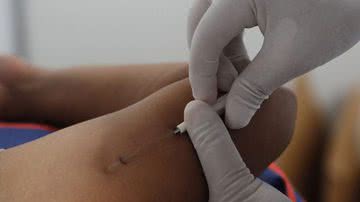 Imagem Anvisa proíbe propaganda de produtos com gestrinona, o 'chip da beleza'