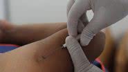 Imagem Anvisa proíbe propaganda de produtos com gestrinona, o 'chip da beleza'