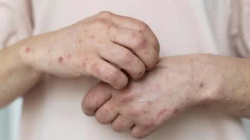 Divulgação // Prefeitura