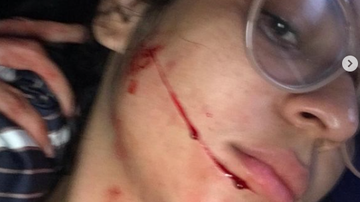 Repodução/ Redes Sociais