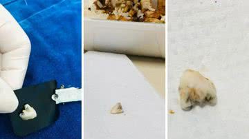 Reprodução/NSC Total