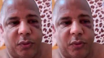 FOTO: REPRODUÇÃO / INTERNET