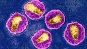 Reprodução //  Cavallini James/BSIP/Science