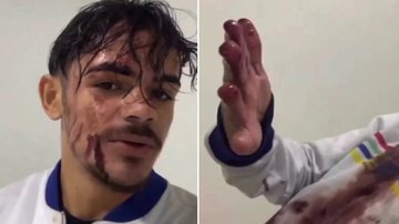 Reprodução/ Vídeo