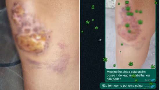 Reprodução G1