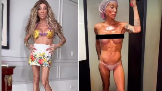 Reprodução Redes sociais