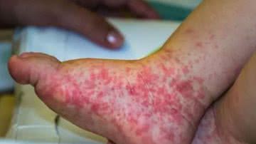 Divulgação / Prefeitura de Araguaína