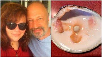 Imagem ‘Achei que era meu dente’: Homem encontra pérola de R$ 500 mil durante o jantar