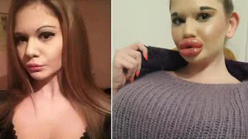 Reprodução | Redes Sociais