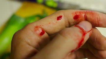 Foto Ilustrativa/Reprodução/Pixelbay