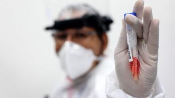 Teste de Covid-19 - Divulgação/Sesab