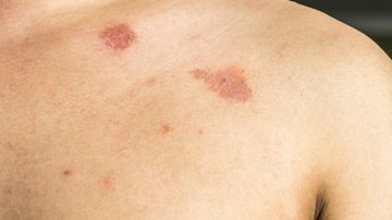 Reprodução Hapivida