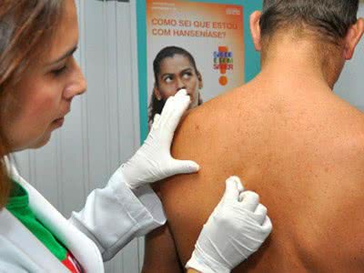 Divulgação/ Fiocruz