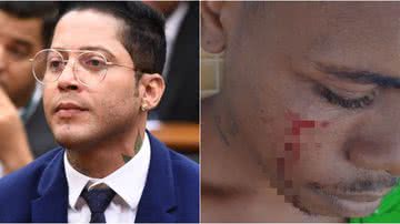 Reprodução/Redes sociais