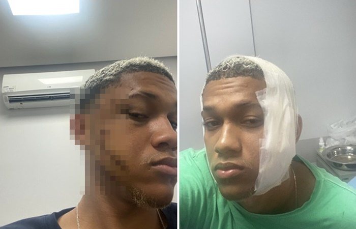 Montagem BNews/Reprodução/Leitor BNews