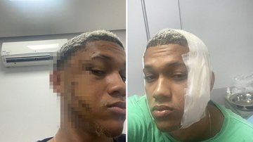 Reprodução/Leitor BNews