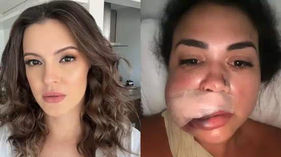 Reprodução / Redes sociais
