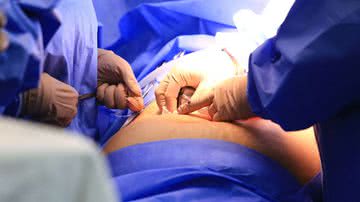 Breno Esaki/Agência Saúde DF