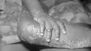 Public Health