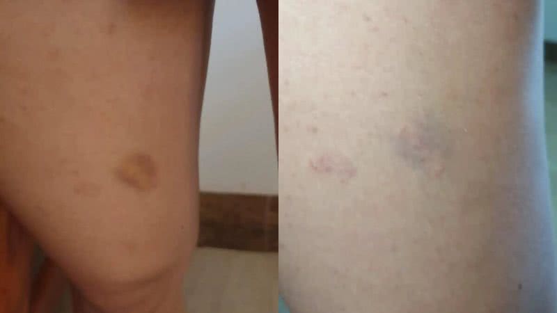 Reprodução/G1