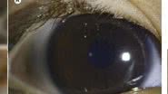 Reprodução/American Journal of Ophthalmology Case Reports