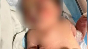 Reprodução// Redes Sociais