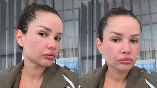 Foto: Reprodução / redes sociais