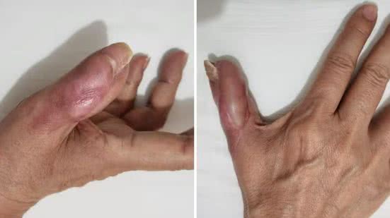 Arquivo pessoal/Bruna Teixeira