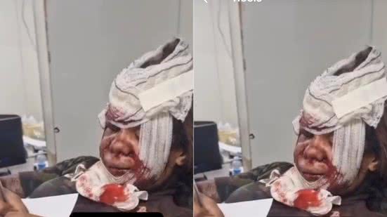 Reprodução | Redes sociais