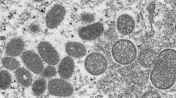 Reprodução Golshimit