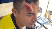 PM foi atingido com tijolo na cabeça - Reprodução/Redes sociais