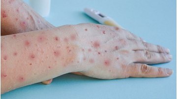 Reprodução/ Freepick