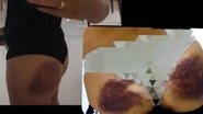 Reprodução/ Redes Sociais