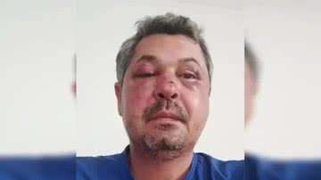 Reprodução / Redes Sociais