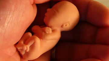 Reprodução / Redes Socias