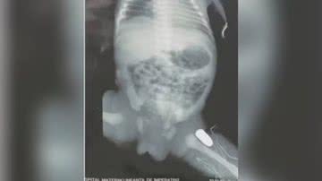 Reprodução/TV Globo