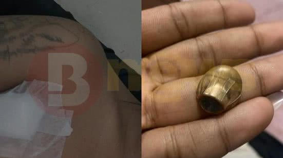 Reprodução/Redes Sociais