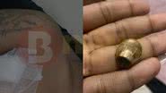 Reprodução/Redes Sociais