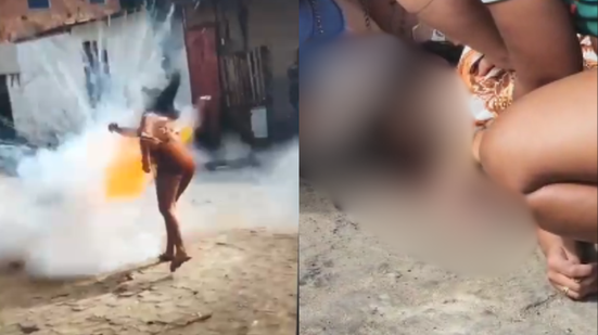 Imagem VÍDEO: Mulher é atingida no rosto por 'espada' em Cruz das Almas e sofre ferimentos graves