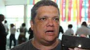 Roberto Viana/ BNews
