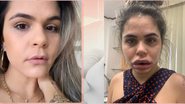 Divulgação/ Rede Globo