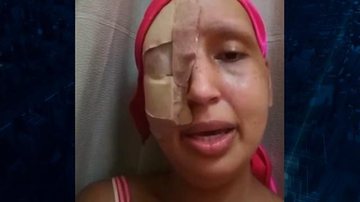 Reprodução/SBT Brasil