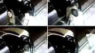 Imagem Vídeo: mulher sofre traumatismo craniano após cotovelada