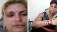 Imagem Ex-mulher de cantor de arrocha acusa vocalista de agressão