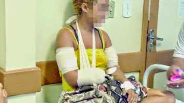 Imagem Mulher chega a hospital segurando a própria mão decepada. Assista
