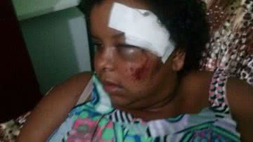 Imagem Após queda em vala, mulher fica sem enxergar e pede ajuda