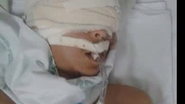 Imagem Família de jovem baleado na cabeça faz protesto pela transferência para Salvador