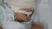 Imagem Família de jovem baleado na cabeça faz protesto pela transferência para Salvador